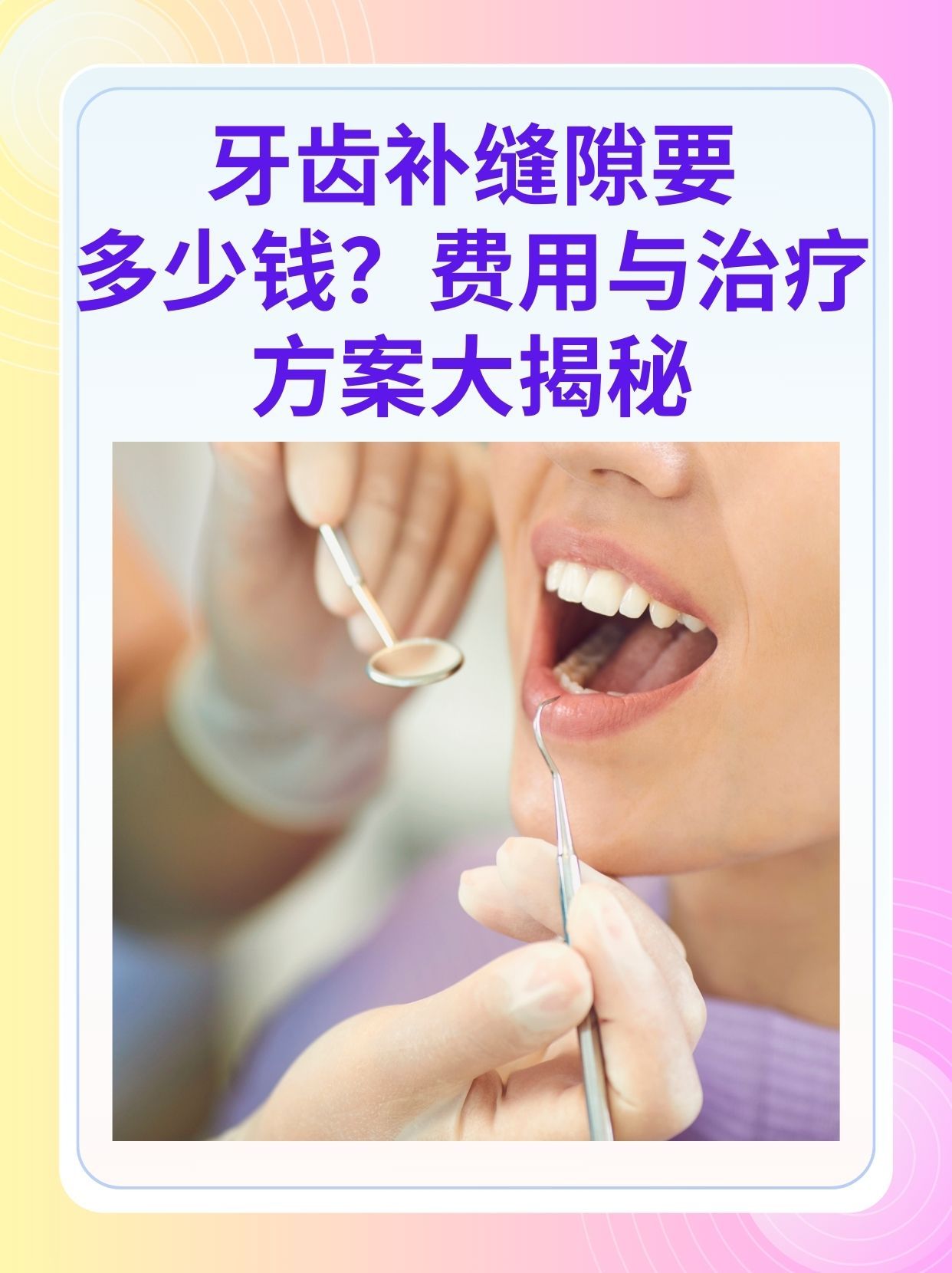 淮南补牙医保可以报销吗(补牙医保可以报销吗 哪些可以报销呢)